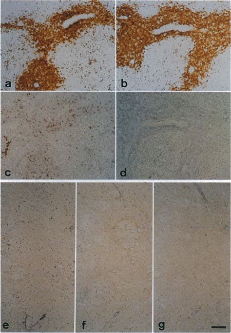 Representative serial sections of splenic tissue from a rat treated... | Download Scientific Diagram