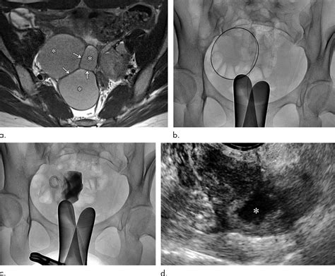 Clinical Course of a 27-Year-O [IMAGE] | EurekAlert! Science News Releases