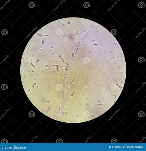 Microscope View of Fungi Mycelium Filaments 40x Increase Stock Photo - Image of micro, microbes ...