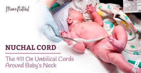 The Truth About Nuchal Cords (Umbilical Cord Around Baby’s Neck)