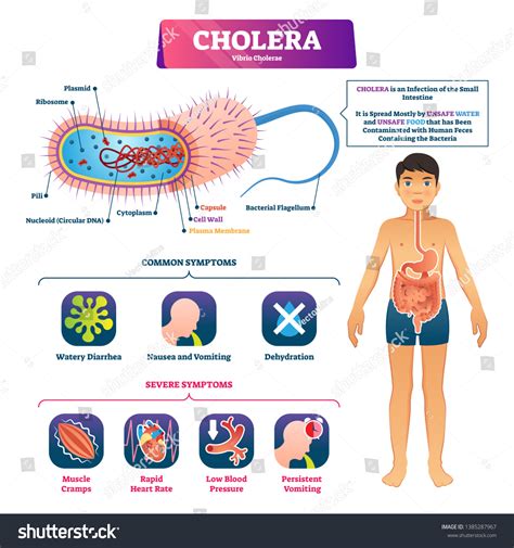 559 Vibrio Cholera Stock Vectors, Images & Vector Art | Shutterstock