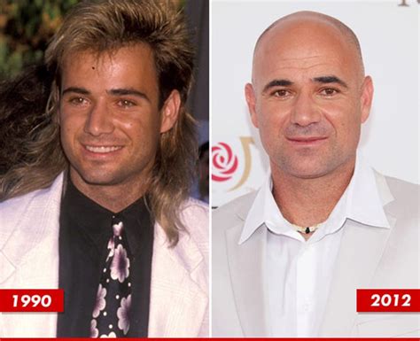 Andre Agassi: Good Genes or Good Docs?