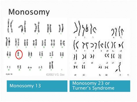 PPT - What is a Karyotype ? PowerPoint Presentation, free download - ID:733355