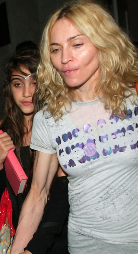 Celebrity Madonna - plastic surgery, photos, video