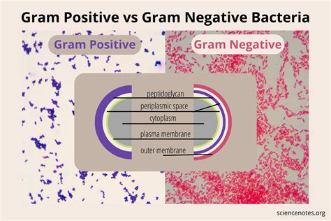 Gram Positive vs Gram Negative Bacteria