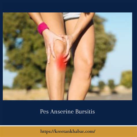 Pes Anserine Bursitis: Causes, Symptoms, and Treatment - Kreetan Khabar 2024