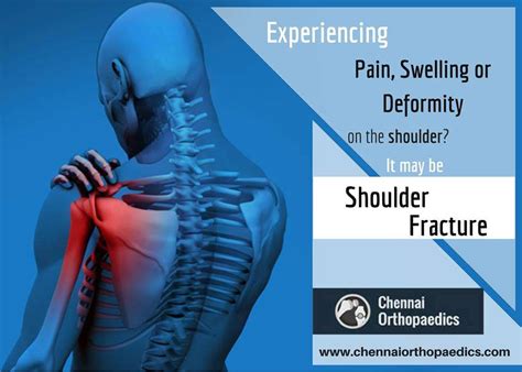 Shoulder Pain Treatment in Chennai- Shoulder Pain Causes