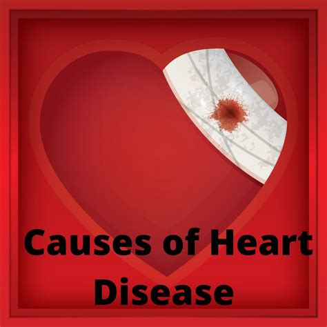 5 Major Causes of Heart Disease You Should Avoid - Thin Strong Healthy