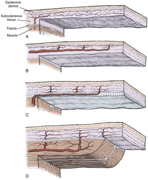 2: Skin Flap Physiology | Pocket Dentistry