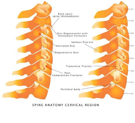 Study: Homeopathy for pains in the neck - Homeopathy Plus