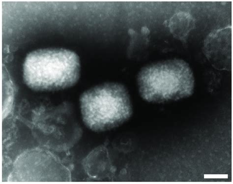 Orthopoxvirus particles. Transmission Electron Microscopy ...