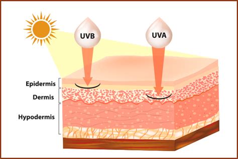 Sunburn: Symptoms, Risk Factors, and Treatment Options