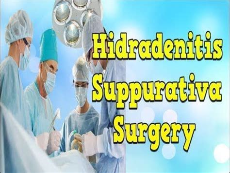 Hidradenitis Suppurativa Surgery Hidradenitis Suppurativa Photos Hidradenitis Suppurativa Nz ...