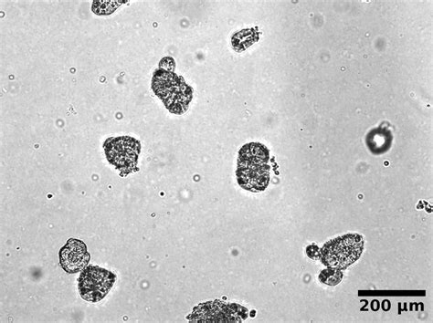 Timeline images of in-vitro intestinal organoid culture. Samples of... | Download Scientific Diagram