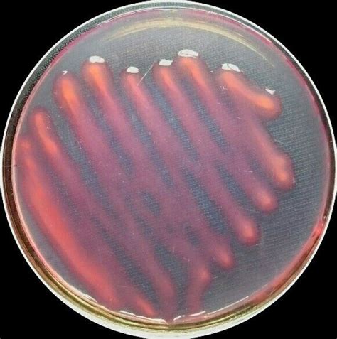 Rhizobium (With images) | Microbiology, Bacteria