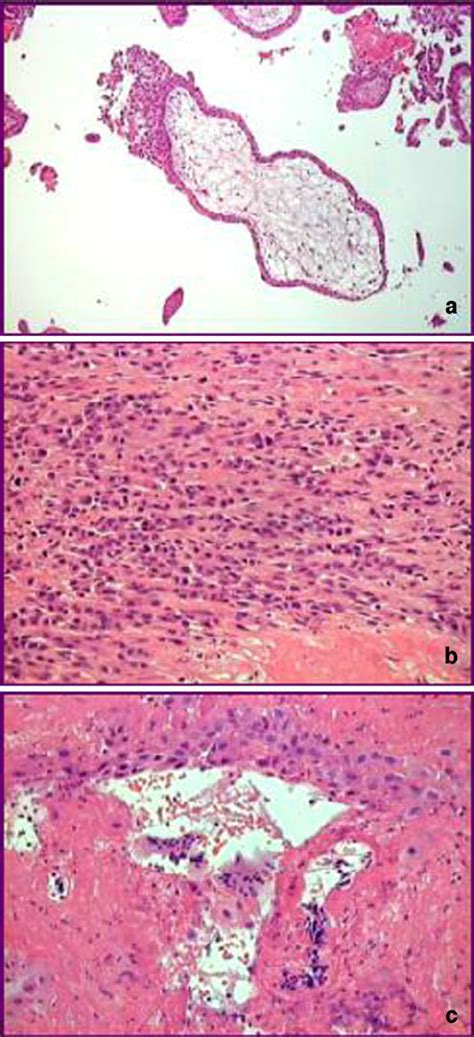 Extravillous trophoblast (EVT) cell populations: cells islands covering... | Download Scientific ...