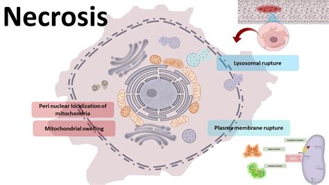 Necrosis: What Is, Types, Symptoms, Risk Factors, and Treatment ...