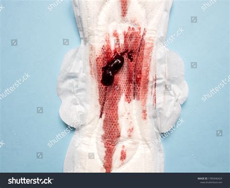 Symptom Endometriosis Menstrual Blood Blood Clots Stock Photo 1785946424 | Shutterstock