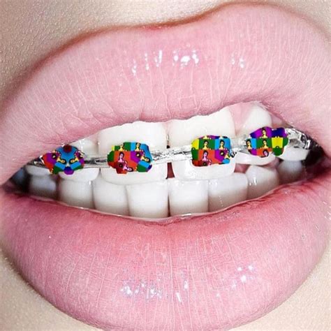 Different swag Diy Braces, Dental Braces, Teeth Braces, Dental Care, Fake Braces, Silver Braces ...