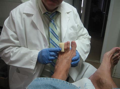 Diabetes And Foot Care. | Foot Care Specialist - Doctor Anthony Chionis