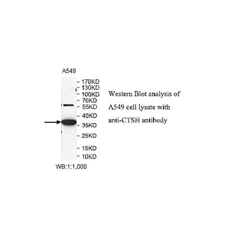 CTSH Antibody Supplier | CAS | AOBIOUS