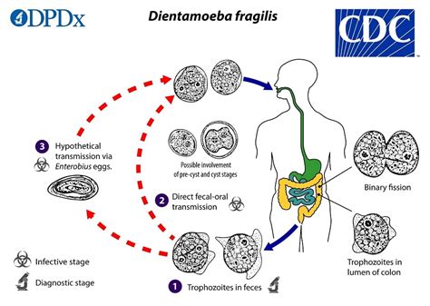 CDC - DPDx - Dientamoeba fragilis Infection