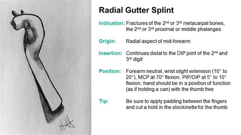 SplintER Series: Common ED Splint Techniques | Splint Principles 104