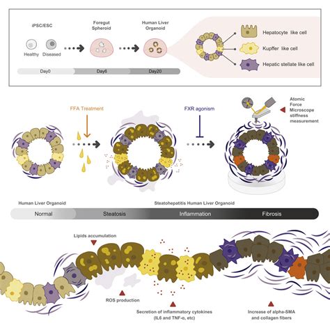 Can Organoids Yield Answers to Fatty Liver Disease ...