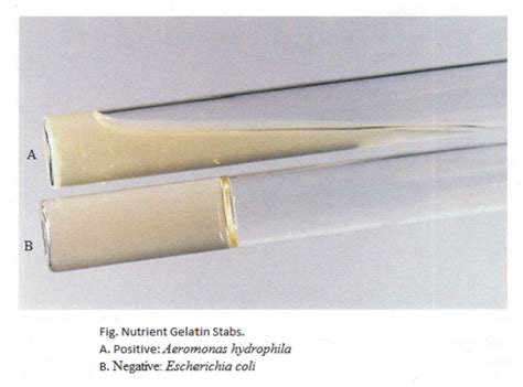 Gelatin Hydrolysis Lab Report 37 kristvala