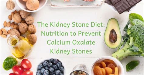 Oxalate Foods To Avoid For Kidney Stones