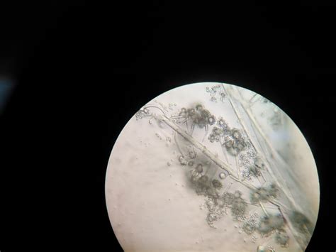 Fungal pathogen under microscope