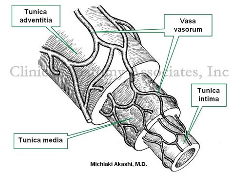 Print Anatomy of the Arteries of the Trunk - Lecture 5 flashcards ...