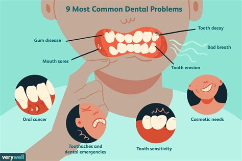 Can You Get Cancer From Not Brushing Your Teeth - TeethWalls