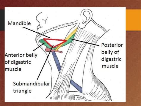 Submandibular Gland Duct