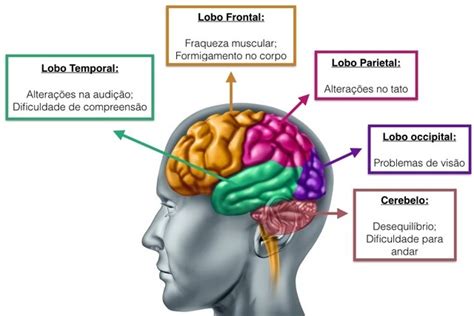 Tumor cerebral: sintomas, tipos e como é feito o tratamento - Tua Saúde