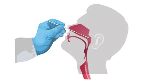 COVID-19 Nasopharyngeal Swabs Packaged in DuPont™ Tyvek® Highlight Swift Response Through ...