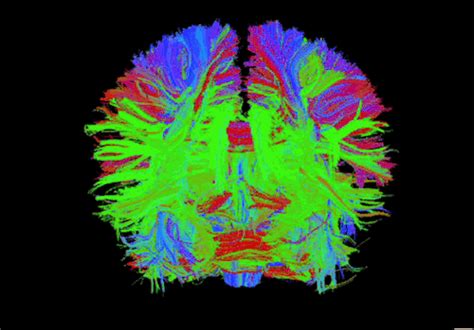 Human brain as seen through new scanner under development at General Electric. Credit: Luca ...