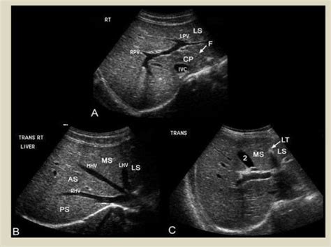 Abdominal Ultrasound Anatomy