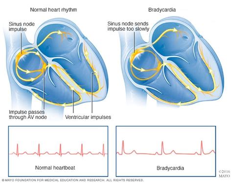 11 Symptoms Of Vagus Nerve Dysfunction