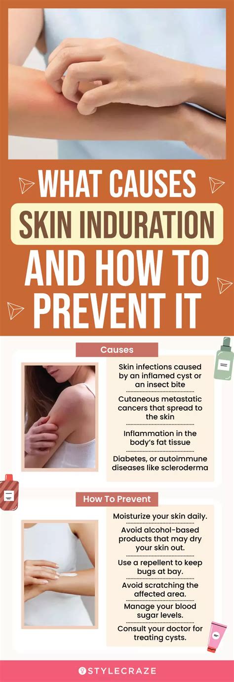 Skin Induration: Symptoms, Causes, And Treatments