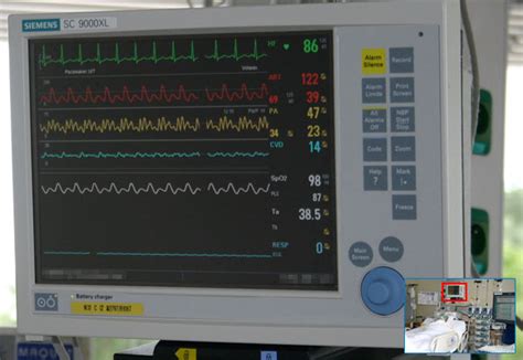 All about medicine: ICU Monitor