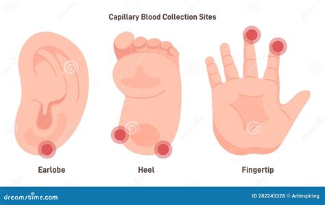 Capillary Blood Sampling Sites. Collection of Capillary Blood from Stock Vector - Illustration ...