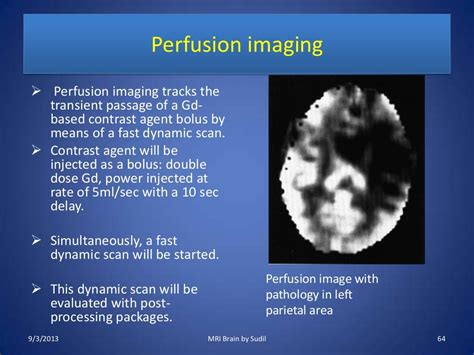 MRI Procedure of Brain