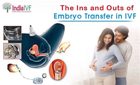 Embryo Transfer in IVF: A Guide by India IVF Fertility