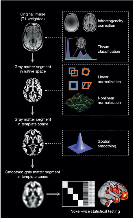 [PDF] Voxel-Based Morphometry | Semantic Scholar