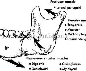 treatment of fracture of mandible | JuniorDentist.com