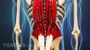 Immediate Treatment for a Back Muscle Strain | Spine-health