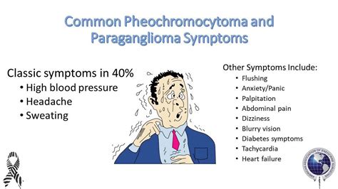 Renovascular Hypertension (RVH) part 3: Clinical presentation and differential diagnosis