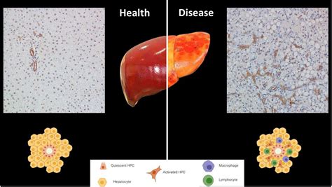 Frontiers | Redox Control of the Immune Response in the Hepatic ...