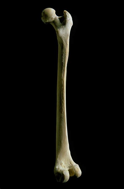 Human Femur Or Thigh Bone Photograph by James Stevenson/science Photo Library. - Pixels